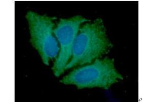 ICC/IF analysis of JAK2 in HeLa cells line, stained with DAPI (Blue) for nucleus staining and monoclonal anti-human JAK2 antibody (1:100) with goat anti-mouse IgG-Alexa fluor 488 conjugate (Green). (JAK2 抗体  (AA 1014-1132))