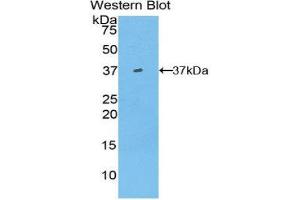 Western Blotting (WB) image for anti-Hepcidin Antimicrobial Peptide (HAMP) (AA 23-82) antibody (ABIN3205705) (Hepcidin 抗体  (AA 23-82))