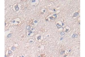 Detection of ATF6 in Human Cerebrum Tissue using Polyclonal Antibody to Activating Transcription Factor 6 (ATF6) (ATF6 抗体  (AA 423-646))
