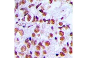 Immunohistochemistry (IHC) image for anti-H2A Histone Family, Member X (H2AFX) (C-Term), (pSer139) antibody (ABIN7302914)