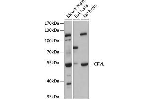 Western blot analysis of extracts of various cell lines, using CPVL antibody (ABIN6130825, ABIN6138985, ABIN6138987 and ABIN6215977) at 1:3000 dilution.
