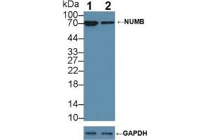 Western Blotting (WB) image for anti-Numb Homolog (NUMB) antibody (ABIN7643785)
