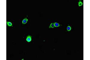 Immunofluorescent analysis of A375 cells using ABIN7171680 at dilution of 1:100 and Alexa Fluor 488-congugated AffiniPure Goat Anti-Rabbit IgG(H+L) (TECPR1 抗体  (AA 199-487))