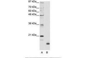 Image no. 1 for anti-Ribosomal Protein L32 (RPL32) (N-Term) antibody (ABIN203010) (RPL32 抗体  (N-Term))