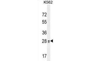 Western Blotting (WB) image for anti-Testis Expressed 13B (TEX13B) antibody (ABIN2995905) (TEX13B 抗体)