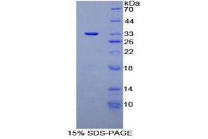 SDS-PAGE (SDS) image for Cardiac Troponin I (TNNI3) (AA 1-211) protein (His tag) (ABIN1821597)