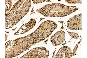 Phospho-RPA32/RPA2 (Ser4/Ser8) Antibody at 1/100 staining Mouse testis tissue by IHC-P.