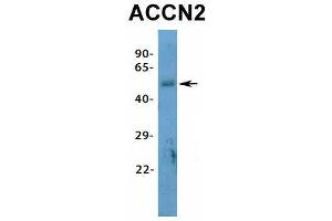 Host:  Rabbit  Target Name:  ACCN2  Sample Type:  Human Fetal Heart  Antibody Dilution:  1. (ASIC1 抗体  (N-Term))
