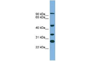 WB Suggested Anti-ASPH Antibody Titration:  0. (Aspartate beta Hydroxylase 抗体  (N-Term))