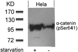 Image no. 1 for anti-Catenin (Cadherin-Associated Protein), alpha 1, 102kDa (CTNNA1) (pSer641) antibody (ABIN401554) (CTNNA1 抗体  (pSer641))