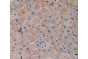 Used in DAB staining on fromalin fixed paraffin- embedded Kidney tissue (MTERF 抗体  (AA 1-191))