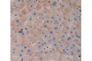 Used in DAB staining on fromalin fixed paraffin- embedded Kidney tissue (MTERF 抗体  (AA 1-191))