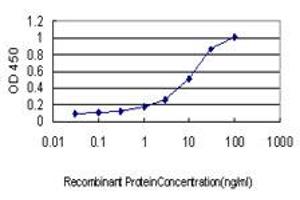 Detection limit for recombinant GST tagged DST is approximately 0. (Dystonin 抗体  (AA 401-500))