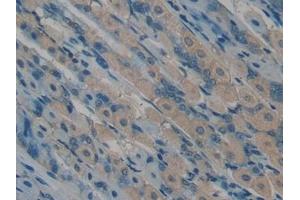 Immunohistochemistry (IHC) image for anti-Osteocalcin (BGLAP) (AA 14-95) antibody (ABIN7431830)