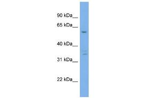 WB Suggested Anti-UBQLN4 Antibody Titration: 0. (UBQLN4 抗体  (Middle Region))