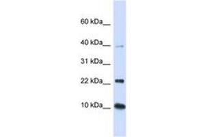 Image no. 1 for anti-Ubiquitin-Conjugating Enzyme E2D 2 (UBE2D2) (N-Term) antibody (ABIN6743143) (UBE2D2 抗体  (N-Term))