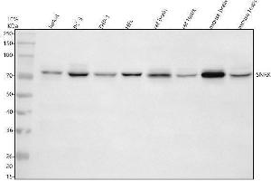 Western blot analysis of SNRK using anti-SNRK antibody (ABIN7825829).