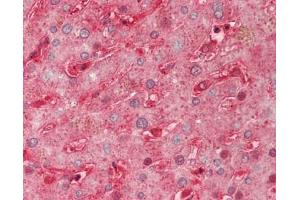 Immunohistochemistry (Paraffin-embedded Sections) (IHC (p)) image for anti-Sema Domain, Immunoglobulin Domain (Ig), Short Basic Domain, Secreted, (Semaphorin) 3A (SEMA3A) (AA 31-141) antibody (FITC) (ABIN2627944)