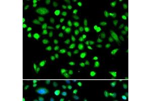 Immunofluorescence analysis of MCF-7 cells using PRKAG1 Polyclonal Antibody (PRKAG1 抗体)