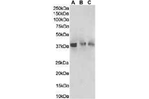 Western Blot using anti-HVEM antibody HMHV-1B18. (Recombinant HVEM 抗体)