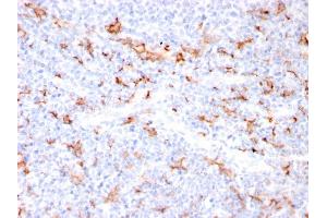 Formalin-fixed, paraffin-embedded human Tonsil stained with S100A8/A9 Complex Recombinant Rabbit Monoclonal Antibody (MAC3157R). (Recombinant S100A8 抗体)