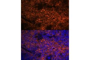Immunofluorescence analysis of mouse spleen using Hemoglobin subunit alpha (HB) (HB) Rabbit mAb (ABIN7267608) at dilution of 1:100 (40x lens). (HBA1 抗体)