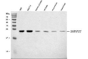 Western blot analysis of SNRNP27 using anti-SNRNP27 antibody (ABIN7599614).