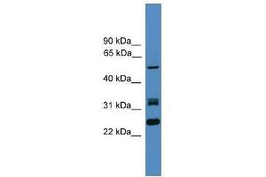 LRRFIP2 antibody used at 0. (LRRFIP2 抗体  (N-Term))