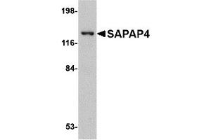 Western Blotting (WB) image for anti-Discs, Large (Drosophila) Homolog-Associated Protein 4 (DLGAP4) (Middle Region) antibody (ABIN1031078) (DLGAP4 抗体  (Middle Region))