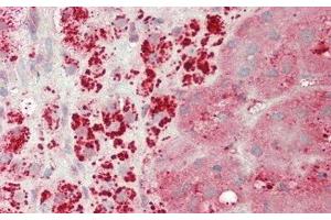 Detection of GLa in Human Adrenal Gland Tissue using Polyclonal Antibody to Galactosidase Alpha (GLa)