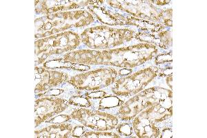 Immunohistochemistry of paraffin-embedded mouse spinal cord using SREBP2 Rabbit pAb (ABIN6128781, ABIN6148430, ABIN6148432 and ABIN6216892) at dilution of 1:50 (40x lens). (SREBF2 抗体  (AA 1-220))