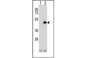 Western Blotting (WB) image for anti-Cytochrome P450, Family 20, Subfamily A, Polypeptide 1 (CYP20A1) (AA 228-258), (Middle Region) antibody (ABIN951777)