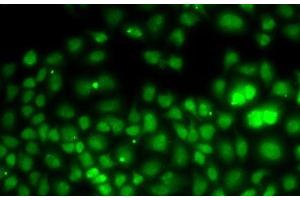 Immunofluorescence analysis of U2OS cells using PCGF6 Polyclonal Antibody