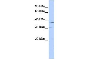 Western Blotting (WB) image for anti-Nuclear Receptor Subfamily 1, Group I, Member 3 (NR1I3) antibody (ABIN2458945) (NR1I3 抗体)