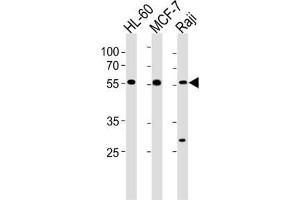 Western Blotting (WB) image for anti-Chromosome 16 Open Reading Frame 71 (C16ORF71) antibody (ABIN3004592) (C16ORF71 抗体)