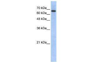 WB Suggested Anti-ARHGAP28 Antibody Titration: 0. (ARHGAP28 抗体  (N-Term))