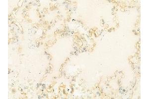 ABIN6263246 and ABIN6274024 at 1/100 staining human normal lung tissue by IHC-P. (MICA 抗体  (C-Term))