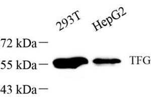 Western blot analysis of TFG (ABIN7076022),at dilution of 1: 1000 (TFG 抗体)