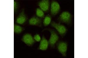 Immunocytochemistry staining of HeLa cells fixed in 1 % Paraformaldehyde and then permeabilized in 0. (WDR77 抗体)