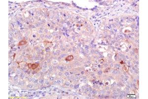 Immunohistochemistry (Paraffin-embedded Sections) (IHC (p)) image for anti-Cannabinoid Receptor 2 (CNR2) (AA 251-350) antibody (ABIN680168)