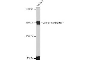 Western Blotting (WB) image for anti-Complement Factor H (CFH) (AA 20-270) antibody (ABIN3023097)