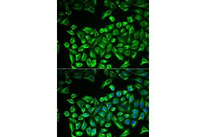 Immunofluorescence analysis of A549 cells using HAS3 antibody. (HAS3 抗体)