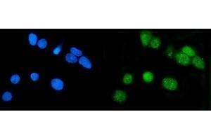 IF analysis of LSM7 using anti-LSM7 antibody (ABIN7598937). (LSM7 抗体  (AA 1-103))