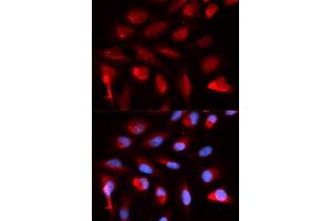 Immunofluorescence analysis of U2OS cells using PPARD antibody (ABIN5973301). (PPARD 抗体)