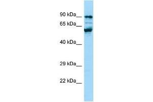 WB Suggested Anti-PPIG Antibody Titration: 1. (PPIG 抗体  (C-Term))