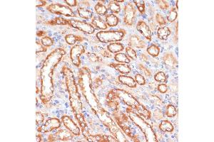 Immunohistochemistry of paraffin-embedded rat kidney using CYB5A antibody (ABIN6130832, ABIN6139296, ABIN6139297 and ABIN6221049) at dilution of 1:100 (40x lens). (CYB5A 抗体  (AA 1-100))