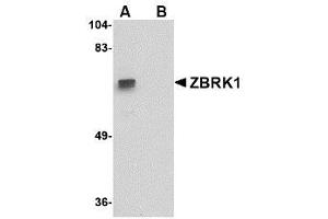 Image no. 1 for anti-Zinc Finger Protein 350 (ZNF350) (C-Term) antibody (ABIN342727) (ZNF350 抗体  (C-Term))