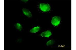 Immunofluorescence of purified MaxPab antibody to TXNDC5 on HeLa cell. (TXNDC5 抗体  (AA 1-360))