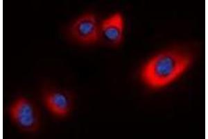 Immunofluorescent analysis of HSP20 (pS16) staining in HEK293T cells. (HSPB6 抗体  (N-Term, pSer16))