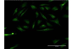 Immunofluorescence of monoclonal antibody to RPS6KA1 on HeLa cell. (RPS6KA1 抗体  (AA 1-735))